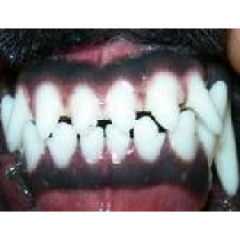 Συμπληρώματα για τη βελτίωση της στοματικής υγιεινής (0)